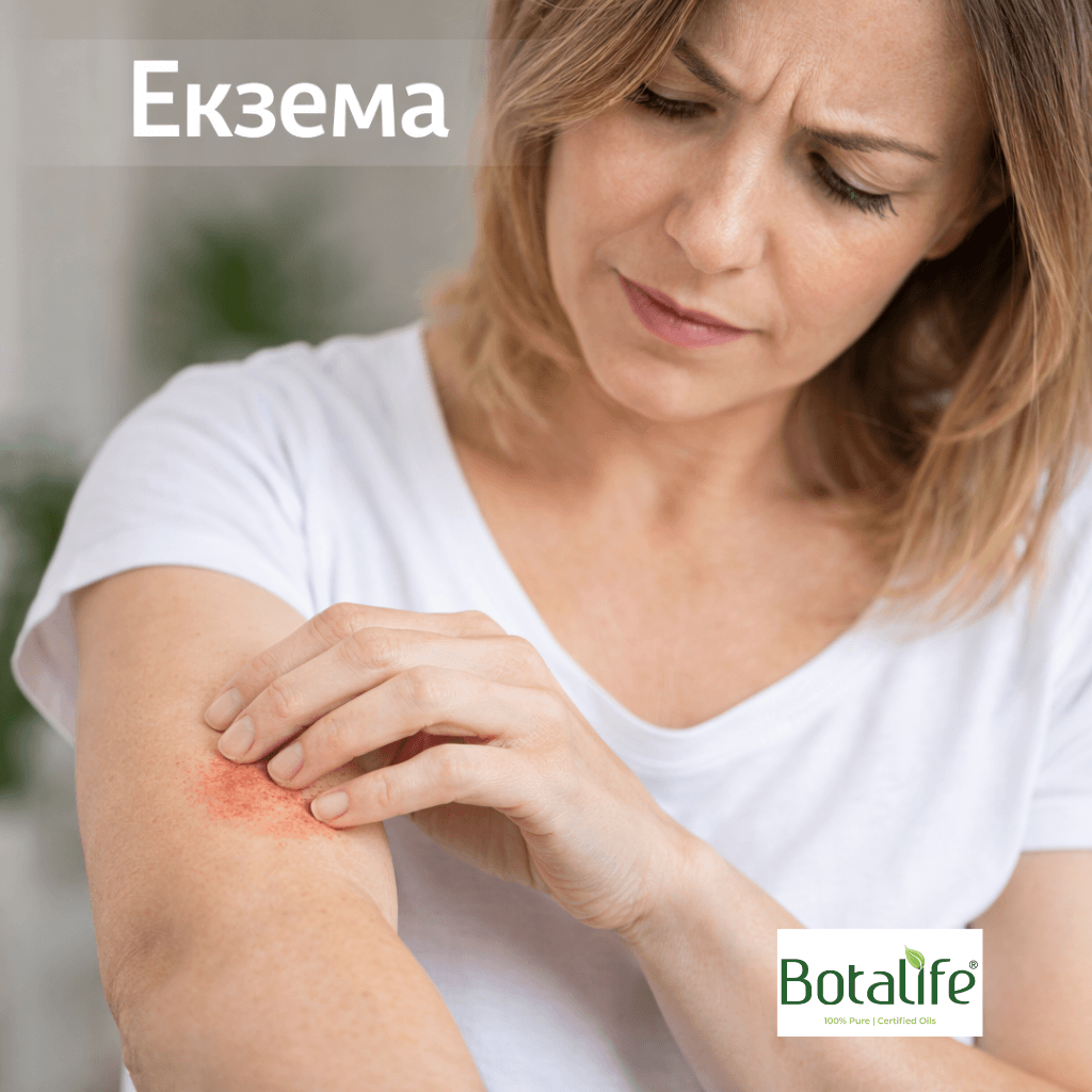 6 етерични масла при екзема – жена търка зачервена кожа на ръка, лечение с етерични масла и продукти Botalife, масло от черен кимьон